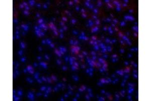 HCRTR1 antibody  (3rd Intracellular Loop)