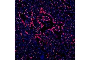 IF analysis of DDX5 using anti-DDX5 antibody (ABIN7602561).