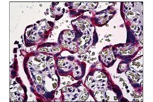Immunohistochemistry (IHC) image for anti-SMAD, Mothers Against DPP Homolog 3 (SMAD3) antibody (ABIN781907) (SMAD3 antibody)