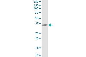 Immunoprecipitation of STX12 transfected lysate using anti-STX12 monoclonal antibody and Protein A Magnetic Bead , and immunoblotted with STX12 MaxPab rabbit polyclonal antibody. (Syntaxin 12 antibody  (AA 108-206))