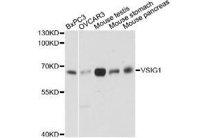 Western blot analysis of extracts of various cell lines, using VSIG1 antibody. (VSIG1 antibody)