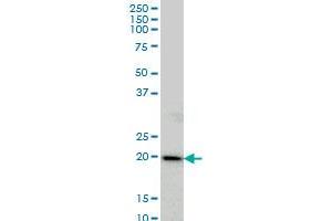 COMMD1 monoclonal antibody (M01), clone 2A12 Western Blot analysis of COMMD1 expression in HeLa . (COMMD1 antibody  (AA 1-190))