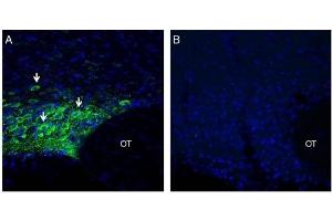 Expression of MAGT1 in rat supra-optic nucleus. (MAGT1 antibody  (Extracellular, N-Term))