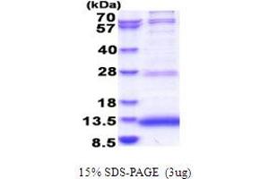 SDS-PAGE (SDS) image for Jumping Translocation Breakpoint (JTB) (AA 31-105) protein (His tag) (ABIN5777842) (JTB Protein (AA 31-105) (His tag))