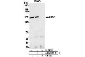 Immunoprecipitation (IP) image for anti-URB2 Ribosome Biogenesis 2 Homolog (URB2) (AA 1474-1524) antibody (ABIN7449667) (URB2 antibody  (AA 1474-1524))