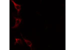 ABIN6267612 staining HeLa cells by IF/ICC. (LIPE antibody  (pSer552))