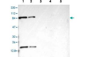 Western blot analysis of Lane 1: RT-4, Lane 2: U-251 MG, Lane 3: Human Plasma, Lane 4: Liver, Lane 5: Tonsil with CD2AP polyclonal antibody  at 1:250-1:500 dilution. (CD2AP antibody)