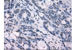 Image no. 8 for anti-Interferon Regulatory Factor 3 (IRF3) antibody (ABIN1498899) (IRF3 antibody)