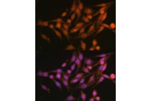 Immunofluorescence analysis of HeLa cells using PSMD13 Polyclonal Antibody (ABIN6132189, ABIN6146337, ABIN6146339 and ABIN6222707) at dilution of 1:100 (40x lens). (PSMD13 antibody  (AA 1-250))