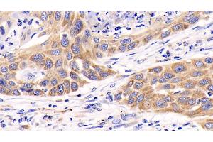 Immunohistochemistry (IHC) image for anti-Mitogen-Activated Protein Kinase 3 (MAPK3) (AA 75-312) antibody (ABIN7426271)