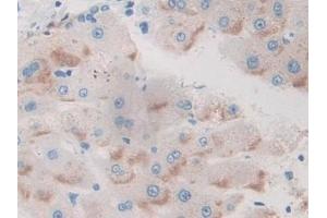 Immunohistochemistry (IHC) image for anti-Basal Cell Adhesion Molecule (Lutheran Blood Group) (BCAM) (AA 32-257) antibody (ABIN7442009)