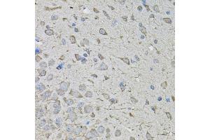 Immunohistochemistry of paraffin-embedded mouse brain using CDK10 antibody. (CDK10 antibody)
