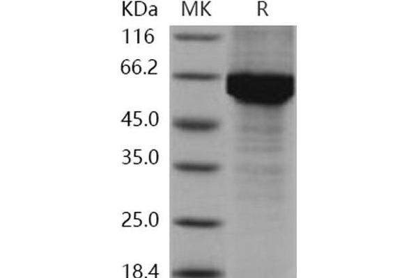 HSP70 1A Protein (His tag)