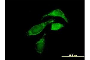 Immunofluorescence of purified MaxPab antibody to OXCT1 on HeLa cell. (OXCT1 antibody  (AA 1-520))