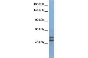 Host:  Rabbit  Target Name:  TEX10  Sample Type:  Fetal Brain lysates  Antibody Dilution:  1.