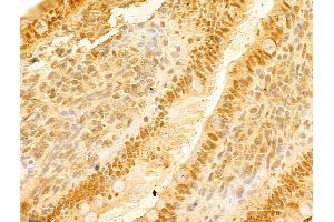 ABIN7094226 and ABIN7098273 at 1/100 staining Rat colon tissue by IHC-P. (FBXO7 antibody  (C-Term))