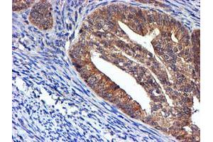 Image no. 11 for anti-NADH Dehydrogenase (Ubiquinone) Complex I, Assembly Factor 7 (NDUFAF7) antibody (ABIN1499667) (NDUFAF7 antibody)