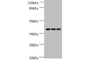 Western blot All lanes: Paired box protein Pax-4 antibody at 6 μg/mL Lane 1: Hela whole cell lysate Lane 2: K562 whole cell lysate Lane 3: Mouse pancreatic Secondary Goat polyclonal to rabbit IgG at 1/10000 dilution Predicted band size: 38, 30 kDa Observed band size: 38 kDa (PAX4 antibody  (AA 50-200))
