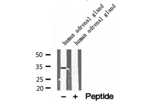 SULT1E1 antibody  (Internal Region)