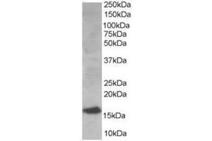 Image no. 1 for anti-Ubiquitin-Conjugating Enzyme E2I (UBE2I) (N-Term) antibody (ABIN374291) (UBE2I antibody  (N-Term))