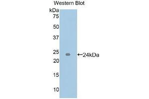 Detection of Recombinant ICAM4, Human using Polyclonal Antibody to Intercellular Adhesion Molecule 4 (ICAM4) (ICAM4 antibody  (AA 52-234))