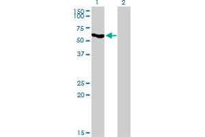 Western Blot analysis of SLC33A1 expression in transfected 293T cell line by SLC33A1 monoclonal antibody (M07), clone 3A4.
