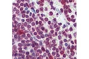 Immunohistochemistry (IHC) image for anti-Cell Division Cycle 25 Homolog A (S. Pombe) (CDC25A) (AA 271-300) antibody (ABIN3030442)