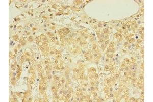 Immunohistochemistry of paraffin-embedded human adrenal gland tissue using ABIN7149631 at dilution of 1:100 (DHRSX antibody  (AA 32-330))