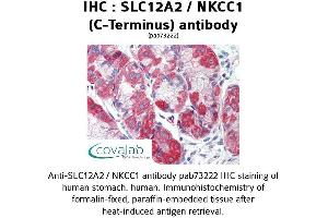 Image no. 2 for anti-Solute Carrier Family 12 (Potassium-Chloride Transporter) Member 2 (SLC12A2) (C-Term) antibody (ABIN1739325) (SLC12A2 antibody  (C-Term))