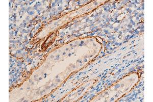 ABIN6267068 at 1/100 staining human seminoma tissue sections by IHC-P. (Smooth Muscle Actin antibody  (N-Term))