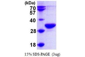 Ribonuclease P/MRP 30kDa Subunit (RPP30) (AA 1-268) protein (His tag)