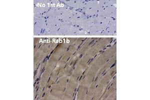 Immunohistochemistry (IHC) image for anti-RAB1B, Member RAS Oncogene Family (RAB1B) (C-Term) antibody (ABIN6254186) (RAB1B antibody  (C-Term))