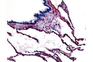 Anti-CAV1 / Caveolin antibody IHC of human respiratory epithelium, bronchial smooth muscle, and alveoli. (Caveolin-1 antibody  (N-Term))