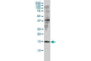 GMFB monoclonal antibody (M01), clone 2G12-2A2 Western Blot analysis of GMFB expression in Jurkat . (GMFB antibody  (AA 1-154))
