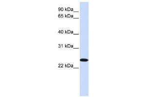 Western Blotting (WB) image for anti-Zinc Finger, DHHC-Type Containing 19 (ZDHHC19) antibody (ABIN2458905) (ZDHHC19 antibody)