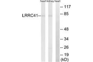 Western blot analysis of extracts from rat kidney/rat heart cells, using LRRC41 Antibody. (LRRC41 antibody  (AA 391-440))