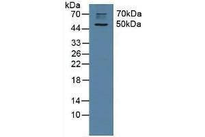 Detection of CHRM1 in Rat Brain Tissue using Polyclonal Antibody to Cholinergic Receptor, Muscarinic 1 (CHRM1)