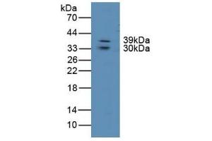 Detection of LIPG in Human Lung Tissue using Polyclonal Antibody to Lipase, Endothelial (LIPG) (LIPG antibody  (AA 175-412))