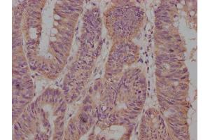 Immunohistochemistry (IHC) image for anti-CD63 (CD63) (AA 103-203) antibody (ABIN7147174)