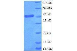 Tumor Necrosis Factor Receptor Superfamily, Member 1A (TNFRSF1A) (AA 31-210) protein (GST tag) (TNFRSF1A Protein (AA 31-210) (GST tag))