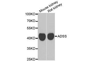 Western blot analysis of extracts of mouse kidney and rat kidney cell lines, using GATM antibody. (GATM antibody)