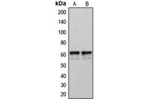 Western blot analysis of Cytochrome P450 2U1 expression in LOVO (A), A2058 (B) whole cell lysates.