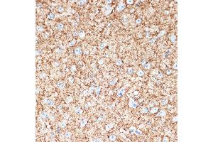 Immunohistochemistry of paraffin-embedded mouse brain using V Rabbit mAb (ABIN7271312) at dilution of 1:100 (40x lens). (VAMP1 antibody)