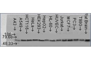 Image no. 1 for anti-V-Akt Murine Thymoma Viral Oncogene Homolog 2 (AKT2) antibody (ABIN264873) (AKT2 antibody)