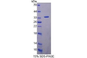 SDS-PAGE (SDS) image for CD34 (CD34) (AA 32-290) protein (His tag) (ABIN1981033) (CD34 Protein (CD34) (AA 32-290) (His tag))