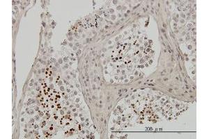 Image no. 1 for anti-Transition Protein 1 (During Histone To Protamine Replacement) (TNP1) (AA 1-56) antibody (ABIN598980) (TNP1 antibody  (AA 1-56))