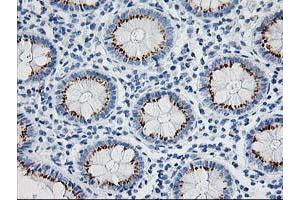 Immunohistochemical staining of paraffin-embedded Human colon tissue using anti-NDEL1 mouse monoclonal antibody. (NDEL1 antibody)