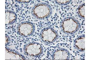 Immunohistochemical staining of paraffin-embedded Human colon tissue using anti-NDEL1 mouse monoclonal antibody.