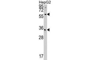 Western Blotting (WB) image for anti-CDP-Diacylglycerol Synthase (Phosphatidate Cytidylyltransferase) 2 (CDS2) antibody (ABIN5018827) (CDS2 antibody)