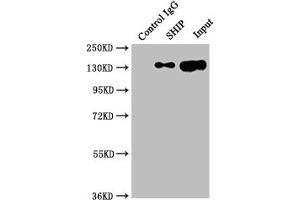 Immunoprecipitating SHIP in Raji whole cell lysate Lane 1: Rabbit control IgG instead of ABIN7127806 in Raji whole cell lysate. (Recombinant INPP5D antibody)